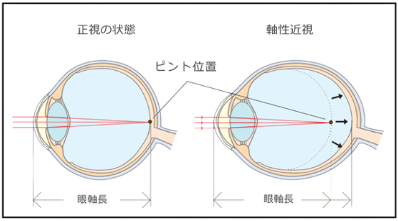 石田眼科　院長