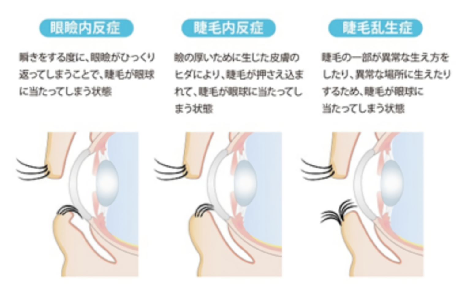 角膜の構造